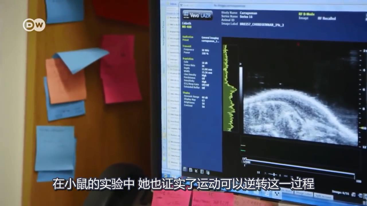 筋膜運動